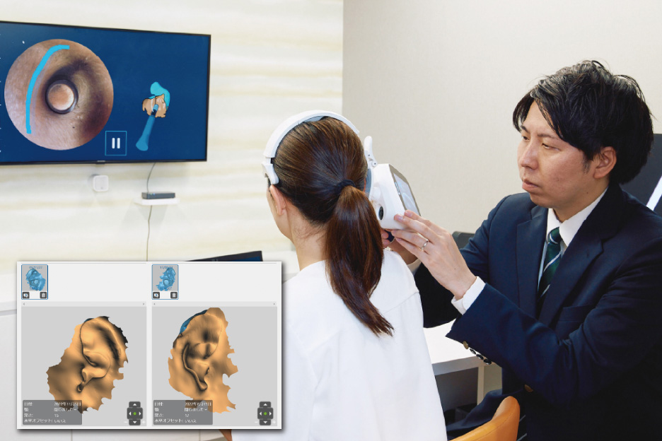 耳型採取イメージ写真